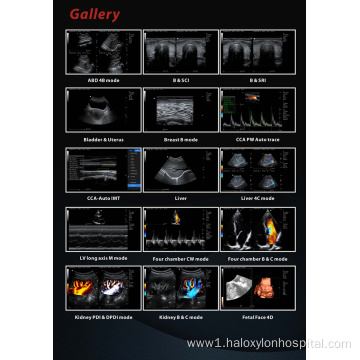 hospital mobile color ultrasound machine laptop cardiac